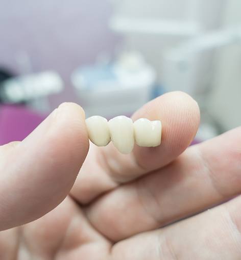 A dentist holding a dental bridge 