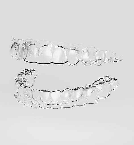 Upper and lower clear aligners pictured against neutral background