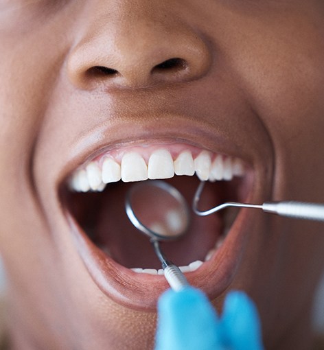 A patient getting a dental checkup