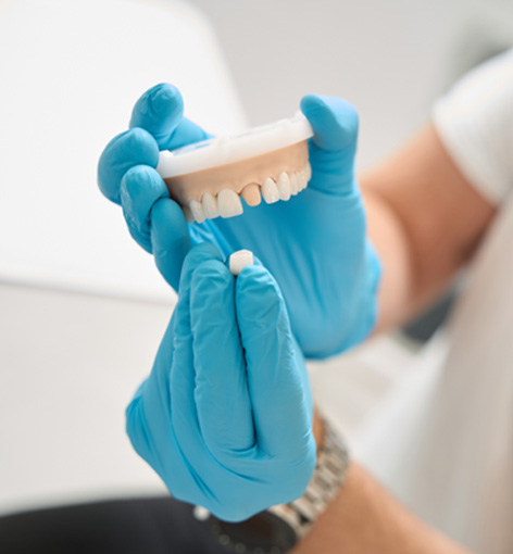 Dentist placing a dental crown on a mouth mold
