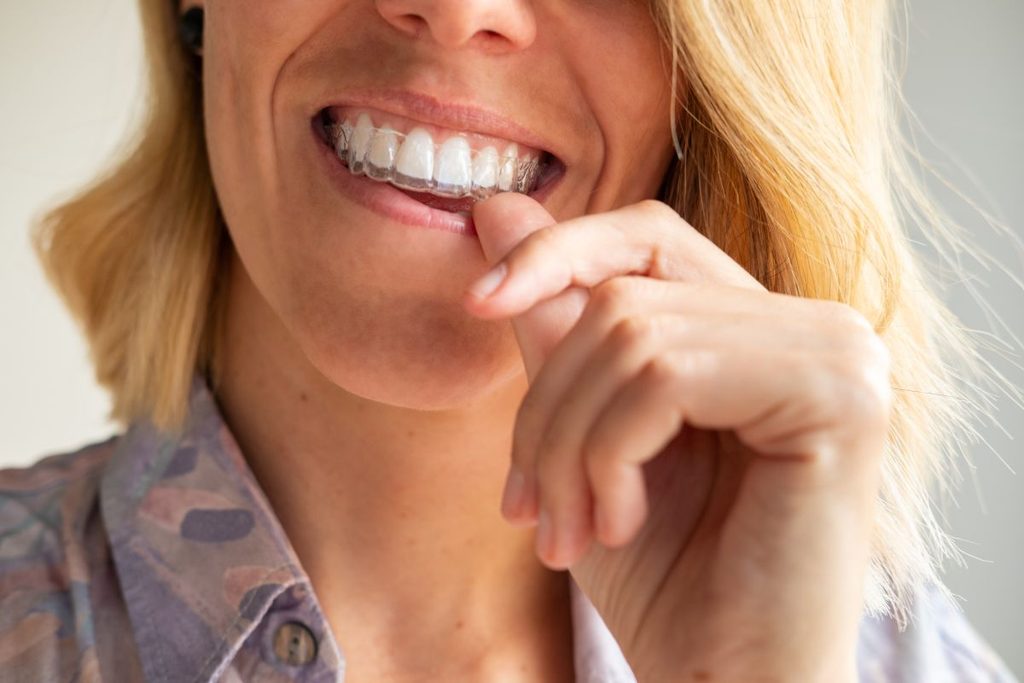 A woman putting on a CandidPro aligner